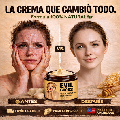 EVILGOODS™ | Bálsamo de sebo de res y miel que calma acné e irritación desde la raíz en 30 días